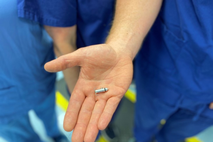 Photo showing a Micra leadless pacemaker in the palm of a person's hand.