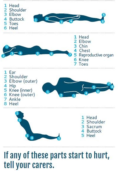 Which parts of your body are most vulnerable to pressure injuries?