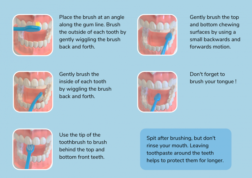 Toothbrushing